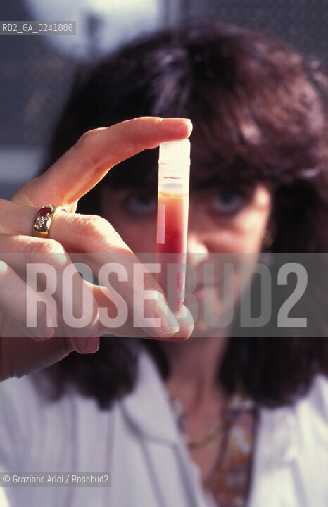 -Bologna,1995.Istituto di ematologia Seragnolidellospedale SantOrsola di Bologna:cellule di midollo osseo congelate pronte per lautotrapianto-Bologna,1995. SeragnoliInstitute of Hematology: bone marrow cells ©Graziano Arici/Rosebud2